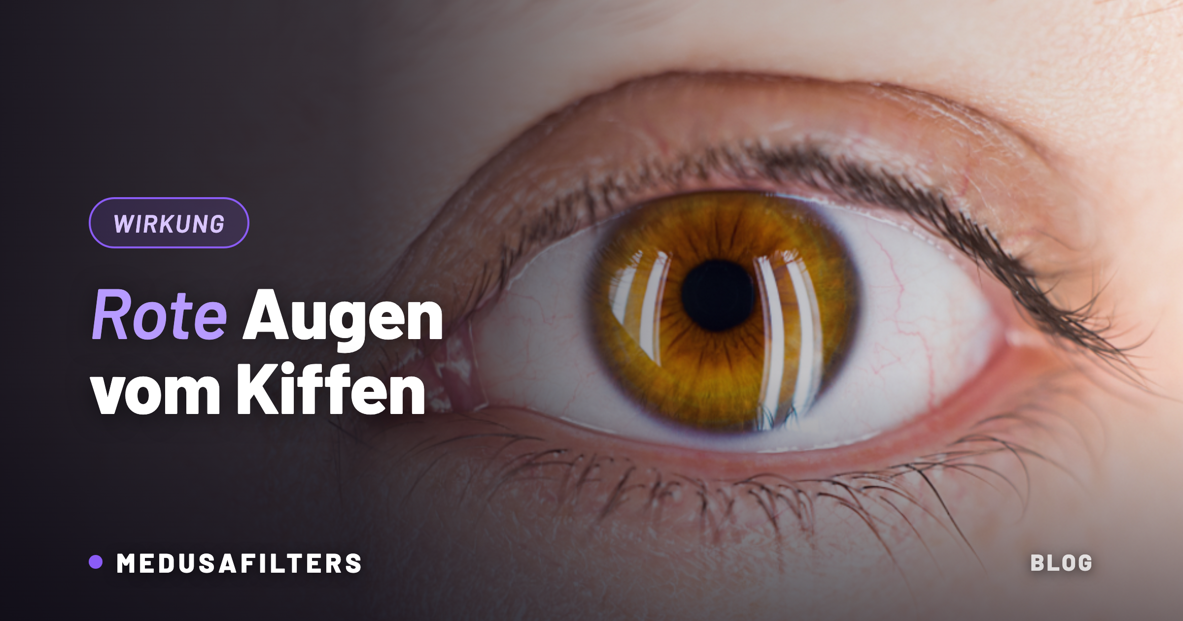 Nahaufnahme eines Auges mit geröteter Bindehaut – rote Augen vom Kiffen